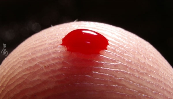 finger-blood-728x728.jpg