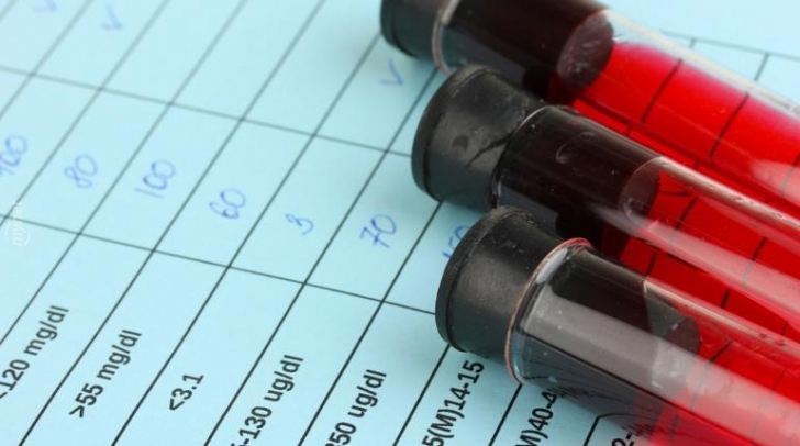 hiv-728x728.jpg
