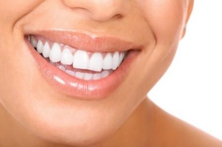 Evde Uygulayabileceğiniz Doğal Diş Beyazlatma Yöntemleri