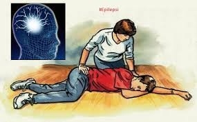Epilepsi Hakkında Herkesin Bilmesi Gereken 10 Temel Bilgi